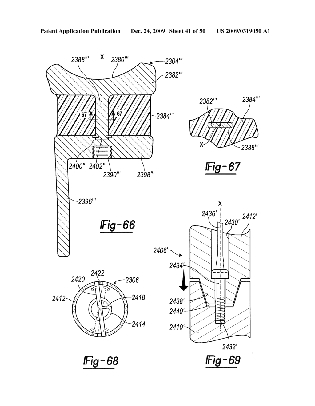 Method and Apparatus for Wrist Arthroplasty - diagram, schematic, and image 42