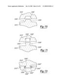 Method and Apparatus for Wrist Arthroplasty diagram and image