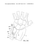 Method and Apparatus for Wrist Arthroplasty diagram and image