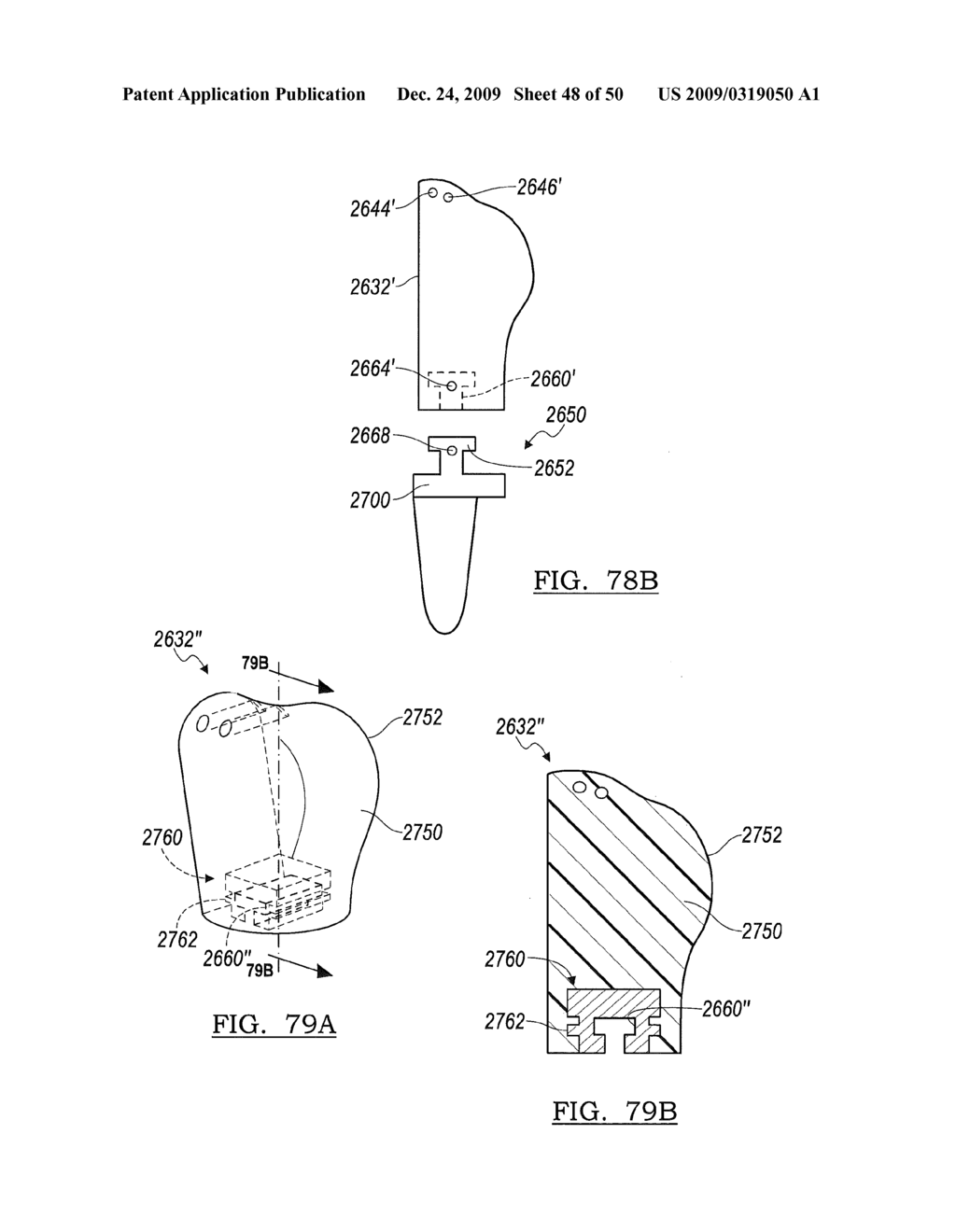 Method and Apparatus for Wrist Arthroplasty - diagram, schematic, and image 49