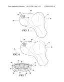 OSTEOCHONDRAL PLUG GRAFT, KIT AND METHOD diagram and image