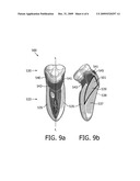 GRIP diagram and image