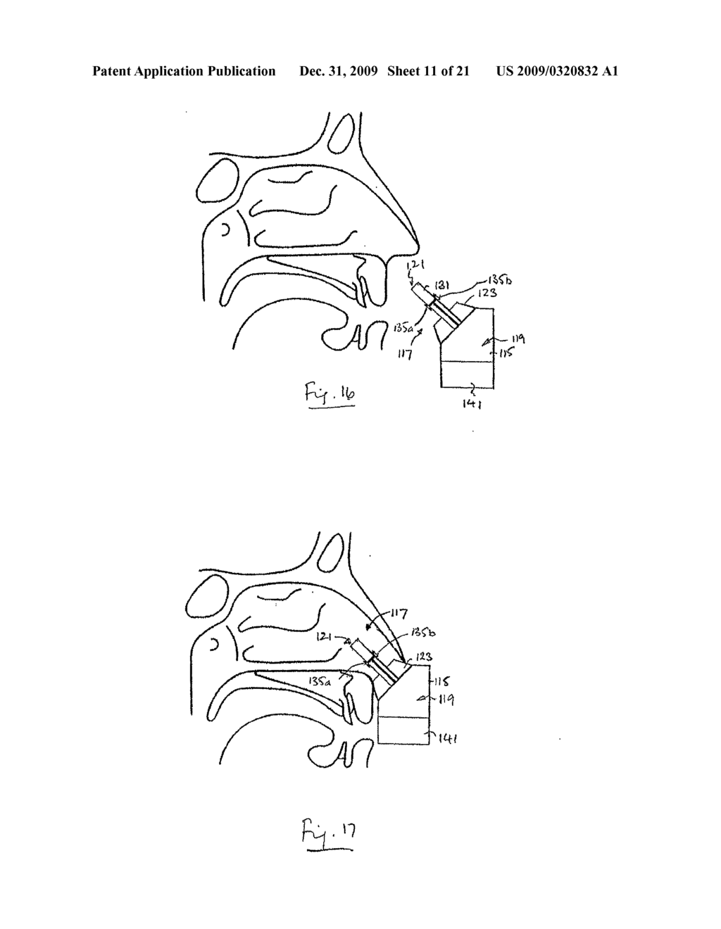 NASAL DELIVERY - diagram, schematic, and image 12