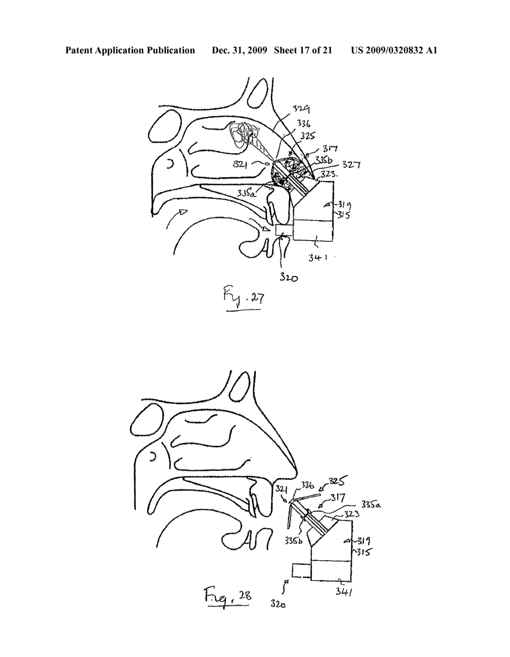 NASAL DELIVERY - diagram, schematic, and image 18