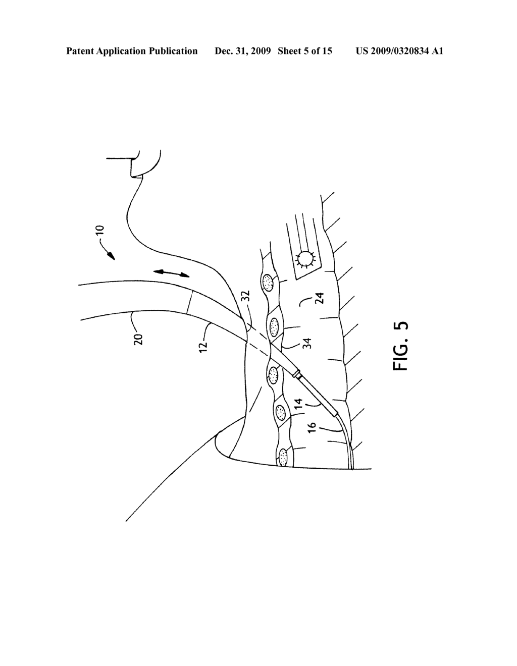 Dilator Loading Catheter - diagram, schematic, and image 06