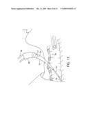 Dilator Loading Catheter diagram and image