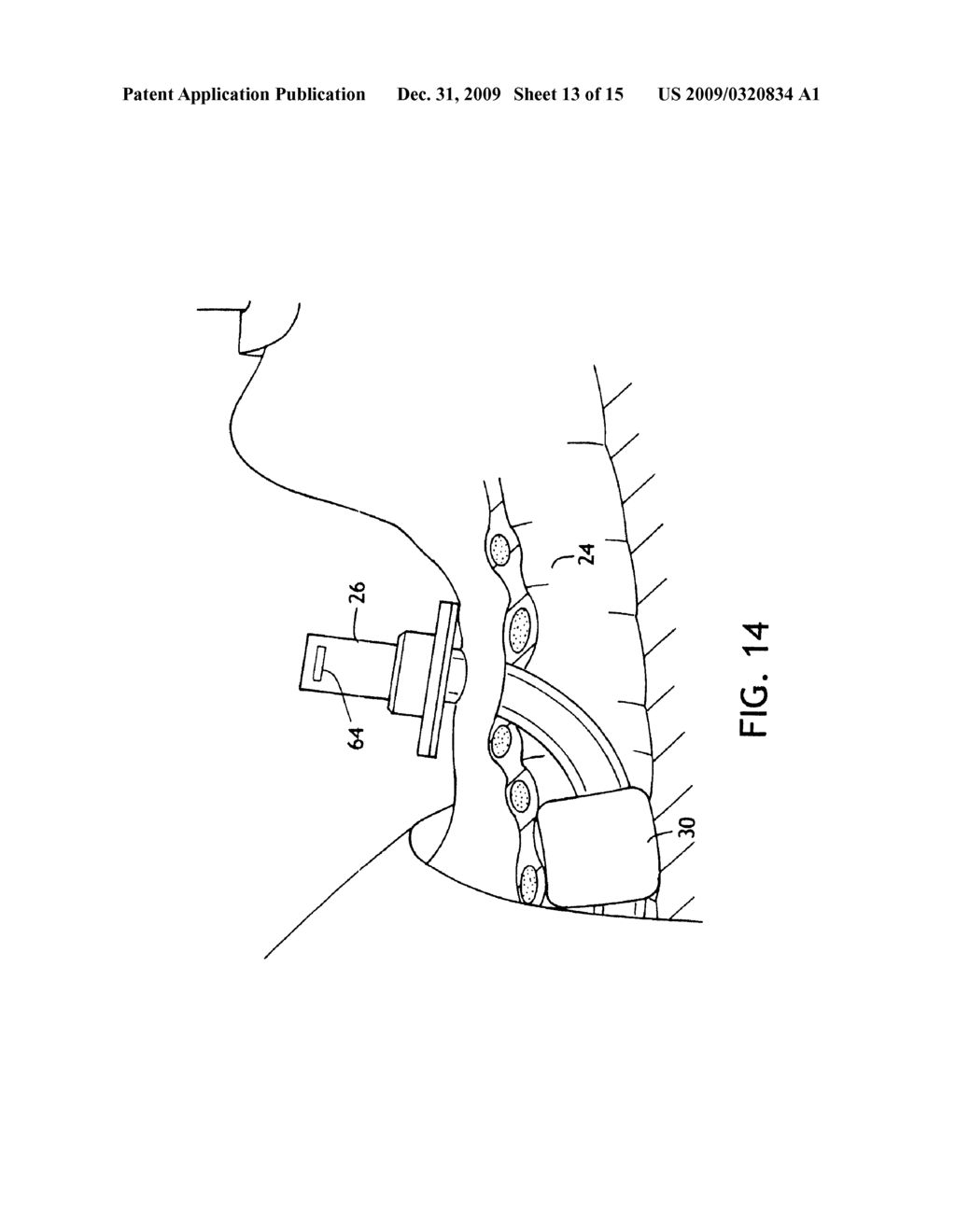 Dilator Loading Catheter - diagram, schematic, and image 14