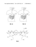 Methods For The Placement Of Sutures In Tissue diagram and image