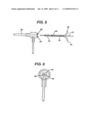 Balloon catheter, its fabrication method, and method for fixedly mounting a balloon on catheter tube diagram and image