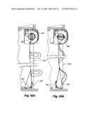 RETRACTABLE SHADE WITH COLLAPSIBLE VANES diagram and image