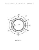 WINDBACK DEVICE diagram and image