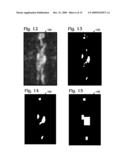 SURVEILLANCE SYSTEMS AND METHODS WITH SUBJECT-RELATED SCREENING diagram and image