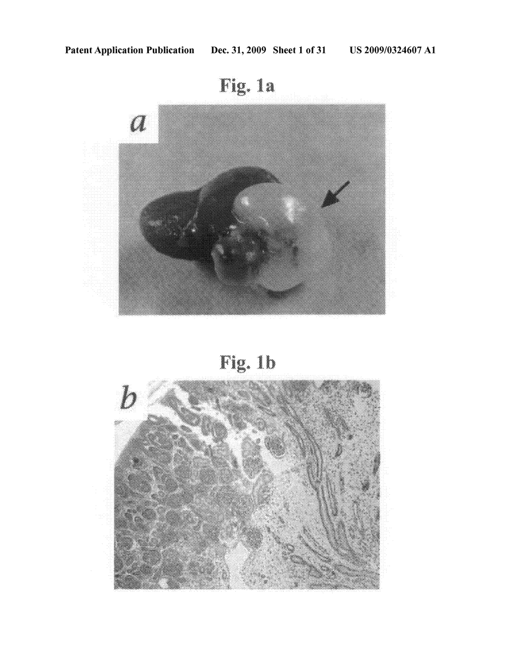 Therapeutic Transplantation Using Developing, Human or Porcine, Renal or Hepatic, Grafts - diagram, schematic, and image 02