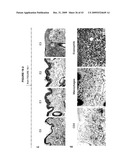 LEISHMANIA VACCINE USING SAND FLY SALIVARY IMMUNOGEN diagram and image