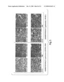 Methods for Stimulating an Immune Response Using Bacterial Antigen Delivery System diagram and image