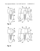 METHOD AND DEVICE FOR PRODUCING TOOTH PROSTHESIS PARTS diagram and image