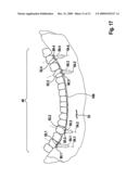 METHOD AND DEVICE FOR PRODUCING TOOTH PROSTHESIS PARTS diagram and image