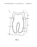 METHOD RELATING TO IMPLANTS, AND A MACHINE-READABLE MEDIUM AND A COMPUTER diagram and image