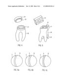 METHOD RELATING TO IMPLANTS, AND A MACHINE-READABLE MEDIUM AND A COMPUTER diagram and image