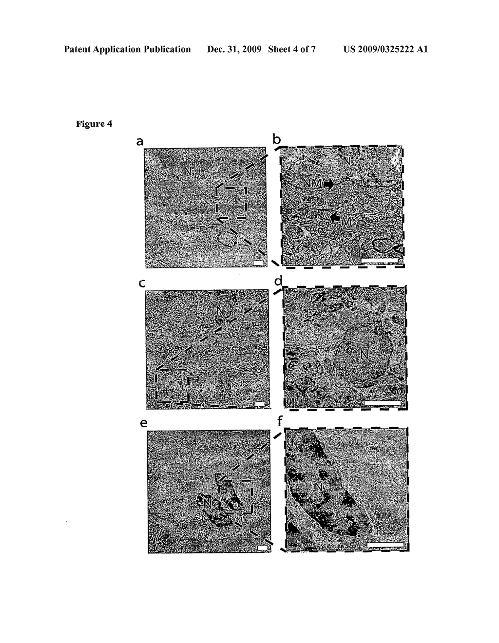 Tissue Sample Preparation and MALDI MS Imaging Thereof - diagram, schematic, and image 05