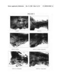 Somatostatin analogs and IGF-I inhibition for breast cancer prevention diagram and image