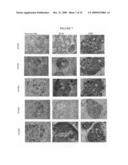 Somatostatin analogs and IGF-I inhibition for breast cancer prevention diagram and image