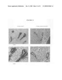 Somatostatin analogs and IGF-I inhibition for breast cancer prevention diagram and image