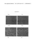 Somatostatin analogs and IGF-I inhibition for breast cancer prevention diagram and image