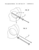 BRACHYTHERAPY APPARATUS FOR ASYMMETRICAL BODY CAVITIES diagram and image