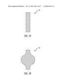 BRACHYTHERAPY APPARATUS FOR ASYMMETRICAL BODY CAVITIES diagram and image