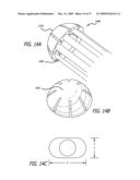 BRACHYTHERAPY APPARATUS FOR ASYMMETRICAL BODY CAVITIES diagram and image