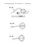 BRACHYTHERAPY APPARATUS FOR ASYMMETRICAL BODY CAVITIES diagram and image