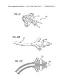 BRACHYTHERAPY APPARATUS FOR ASYMMETRICAL BODY CAVITIES diagram and image