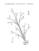 BRACHYTHERAPY APPARATUS FOR ASYMMETRICAL BODY CAVITIES diagram and image