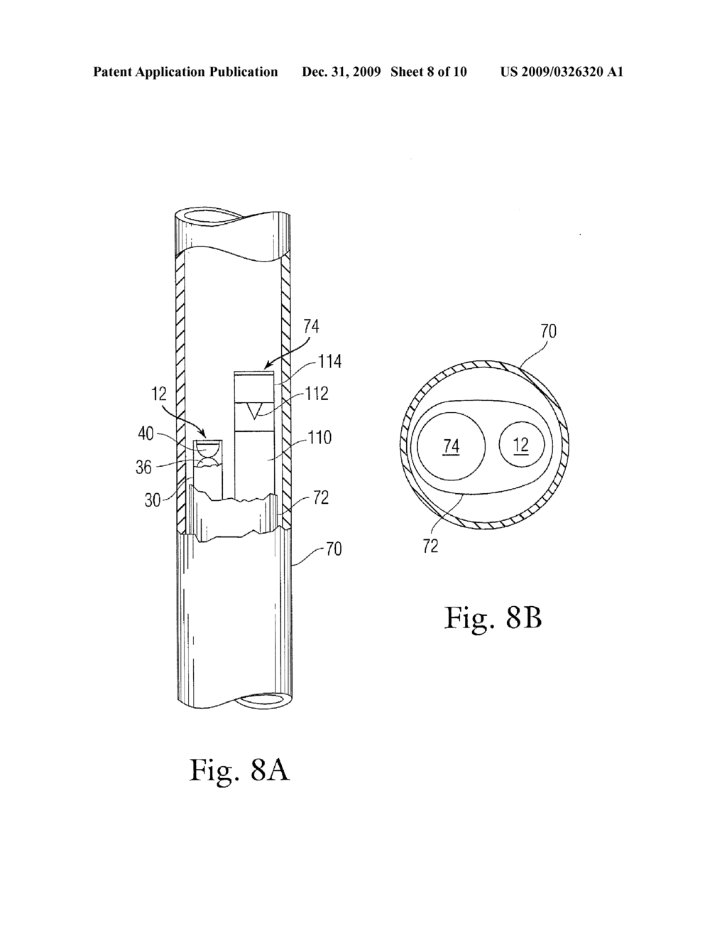 SYSTEM AND METHOD FOR VISUALIZING TISSUE DURING ABLATION PROCEDURES - diagram, schematic, and image 09