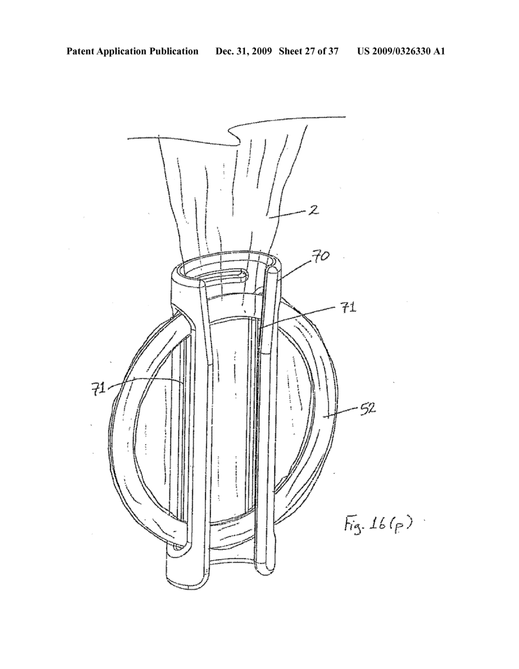 APPARATUS FOR INSERTING A SURGICAL DEVICE AT LEAST PARTIALLY THROUGH A WOUND OPENING - diagram, schematic, and image 28