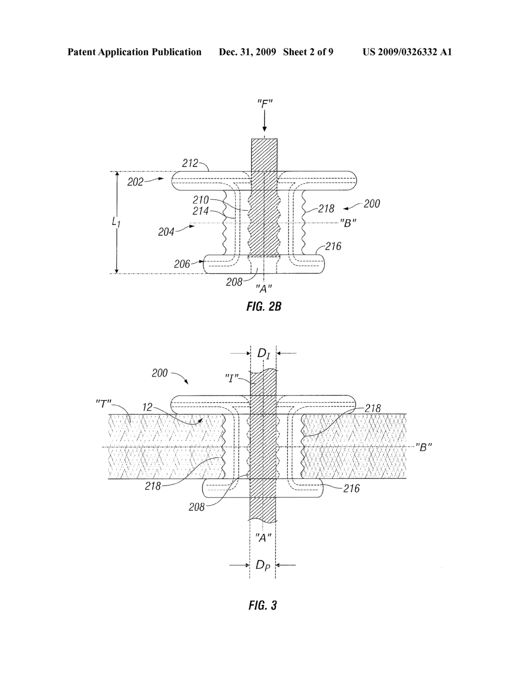 BUTTON PORT - diagram, schematic, and image 03