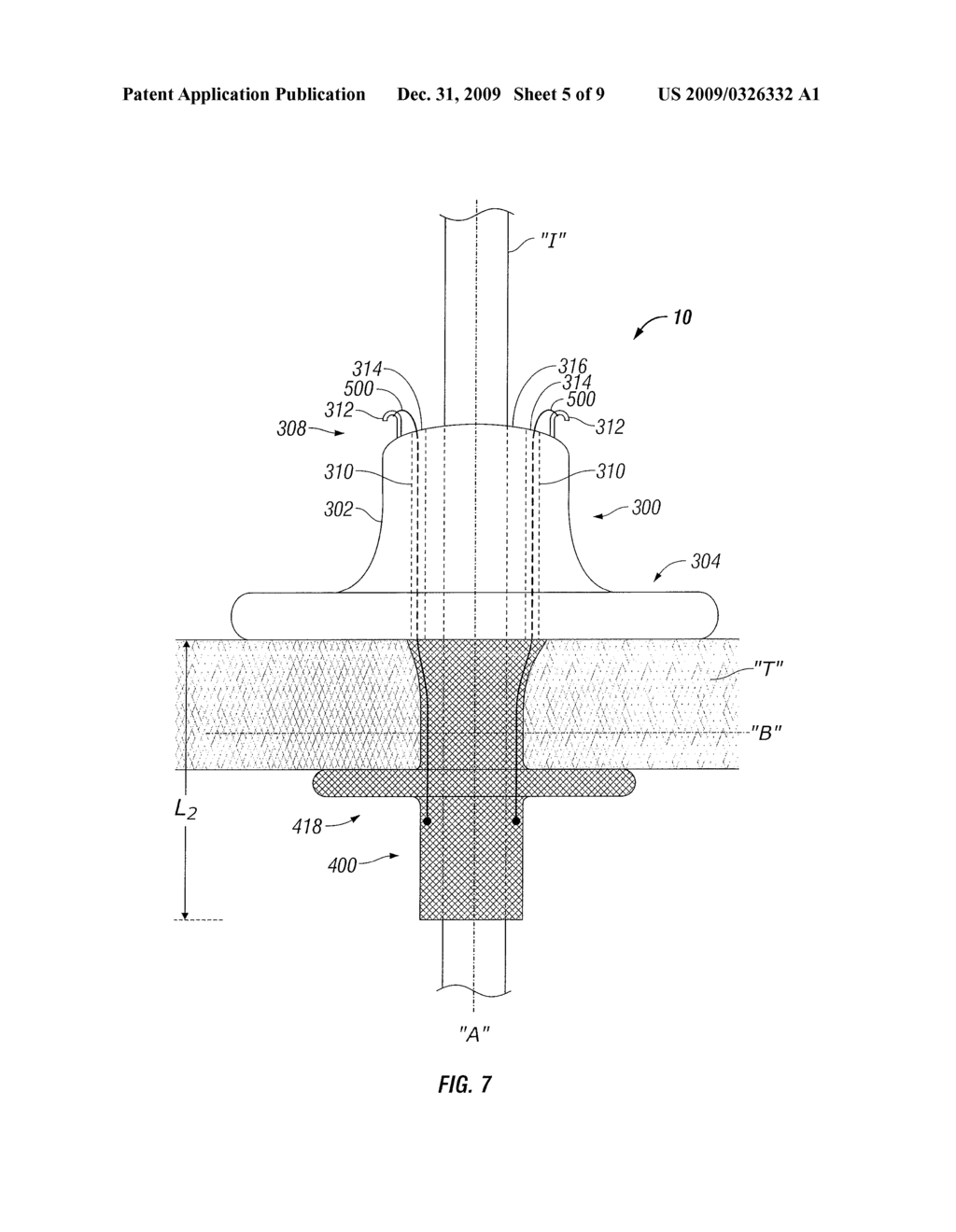 BUTTON PORT - diagram, schematic, and image 06