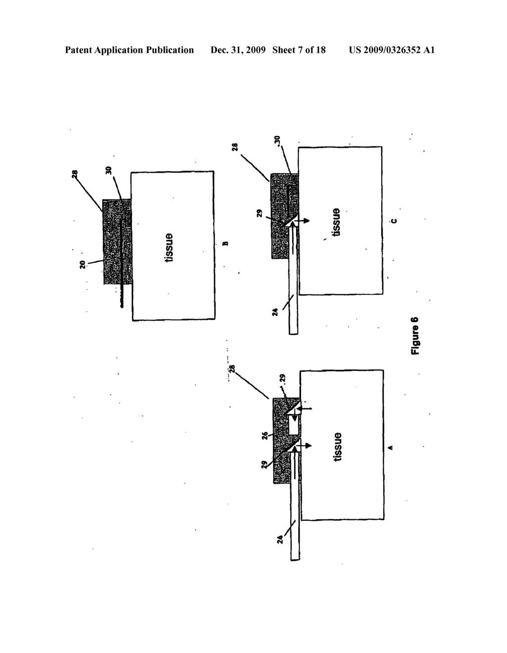 METHOD AND DEVICE FOR MEASURING PARAMETERS OF CARDIAC FUNCTION - diagram, schematic, and image 08