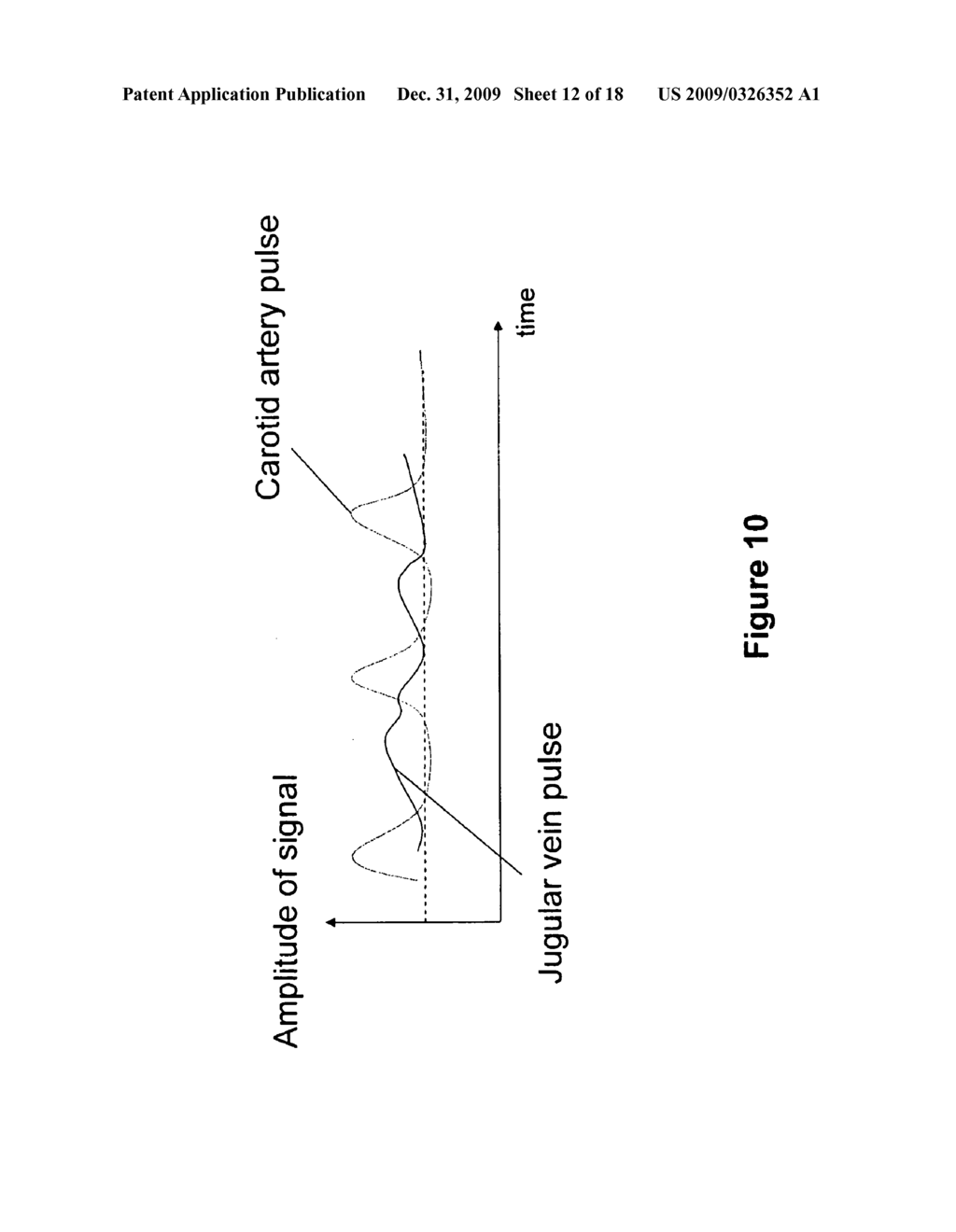 METHOD AND DEVICE FOR MEASURING PARAMETERS OF CARDIAC FUNCTION - diagram, schematic, and image 13