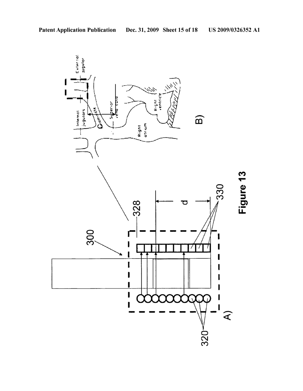 METHOD AND DEVICE FOR MEASURING PARAMETERS OF CARDIAC FUNCTION - diagram, schematic, and image 16