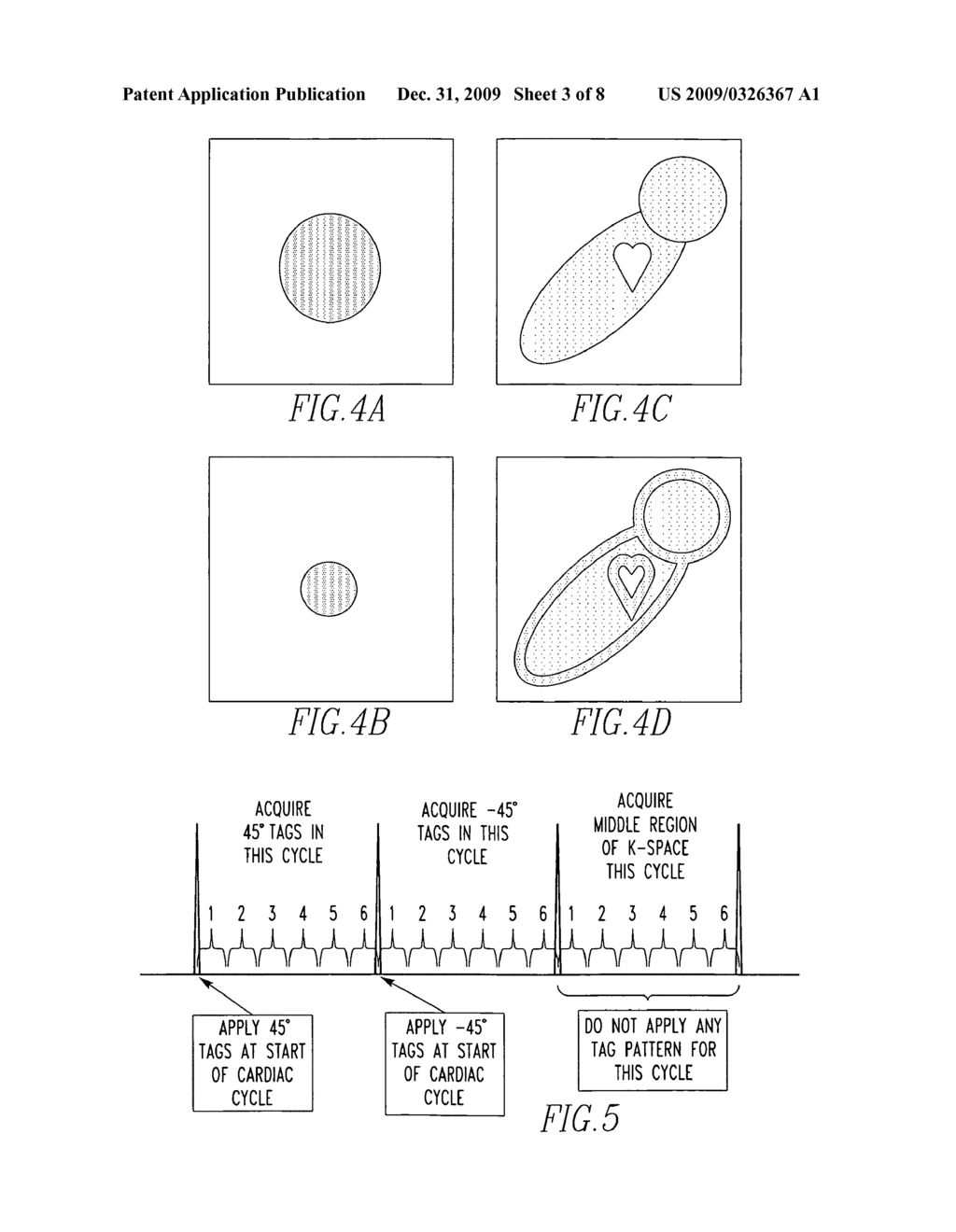 Magnetic resonance imager, method and program which continuously applies steady-state free precession to k-space - diagram, schematic, and image 04