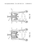 TWO DEGREE OF FREEDOM POWERED ORTHOSIS diagram and image