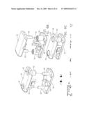 IMPLANTABLE DEVICE FOR THE TREATMENT OF OBESITY diagram and image