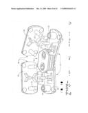 IMPLANTABLE DEVICE FOR THE TREATMENT OF OBESITY diagram and image