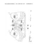 IMPLANTABLE DEVICE FOR THE TREATMENT OF OBESITY diagram and image