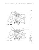 IMPLANTABLE DEVICE FOR THE TREATMENT OF OBESITY diagram and image