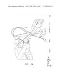 IMPLANTABLE DEVICE FOR THE TREATMENT OF OBESITY diagram and image