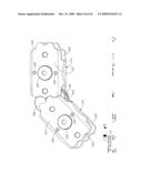 IMPLANTABLE DEVICE FOR THE TREATMENT OF OBESITY diagram and image