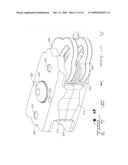 IMPLANTABLE DEVICE FOR THE TREATMENT OF OBESITY diagram and image